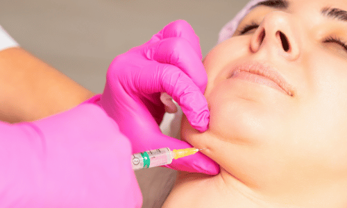 Double Chin Reduction