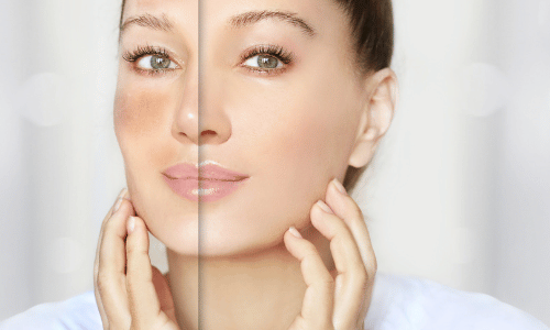 Skin Whitening & Brightening